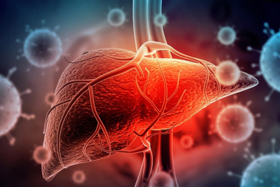 Hepatit taşıyıcıları durumlarını genellikle tesadüfen öğreniyor