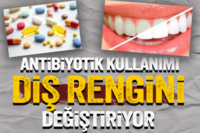 Dişlerinizin sağlığı için antibiyotikten uzak durun