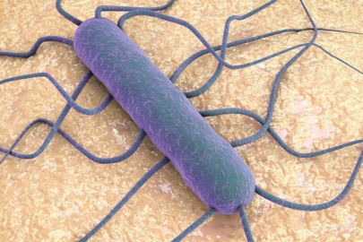 Listeria bakterisi nedeniyle bir bebek öldü